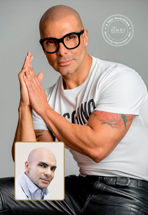 David Elbis - International Makeup Artist and Hairdresser perfomed the procedure of Micro Scalp Pigmentation at Vinci Hair Clinic