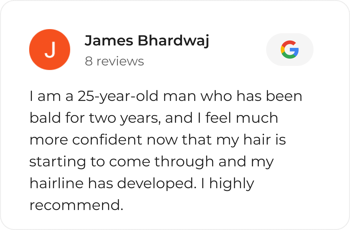 Google review card from a Vinci Hair Clinic patient