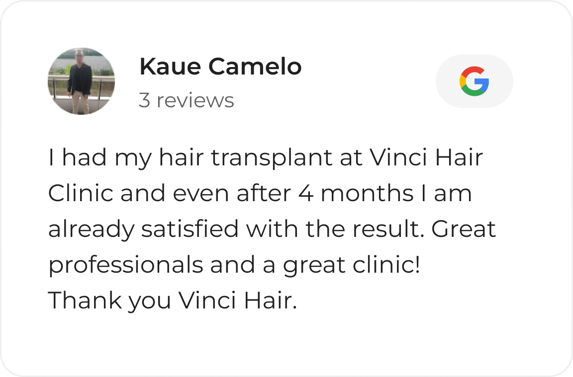 Google review card from a Vinci Hair Clinic patient