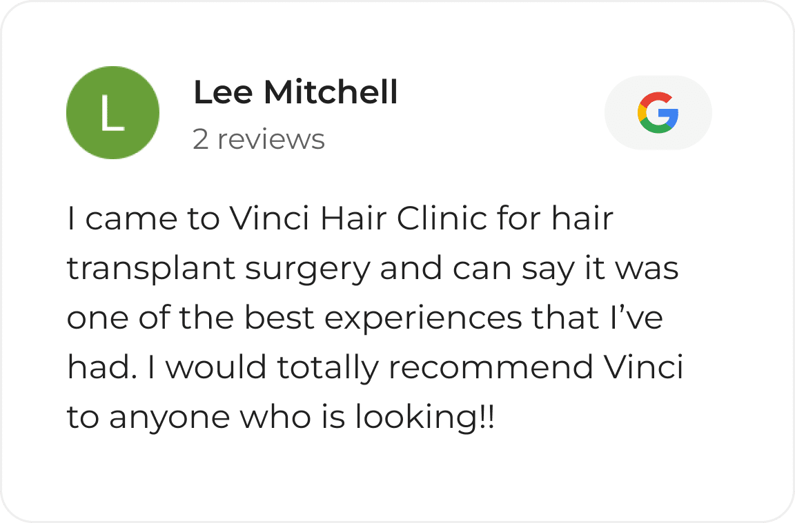 Google review card from a Vinci Hair Clinic patient