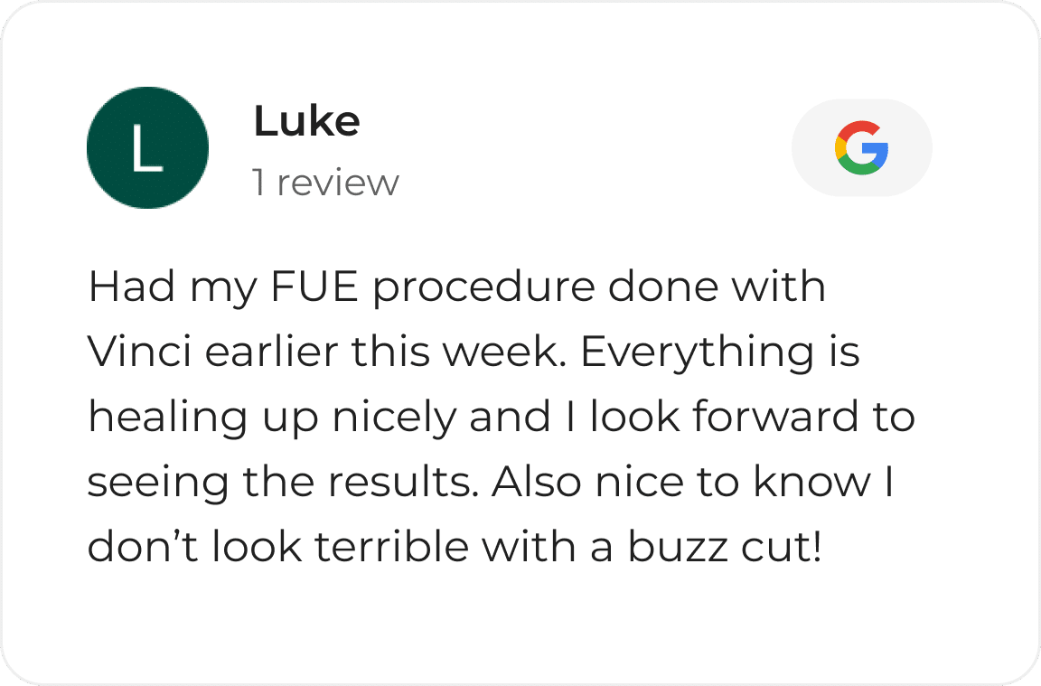 Google review card from a Vinci Hair Clinic patient