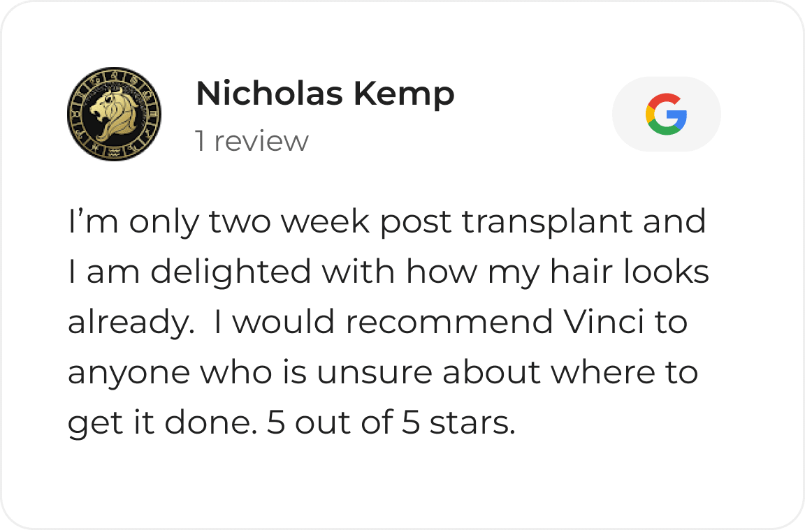 Google review card from a Vinci Hair Clinic patient