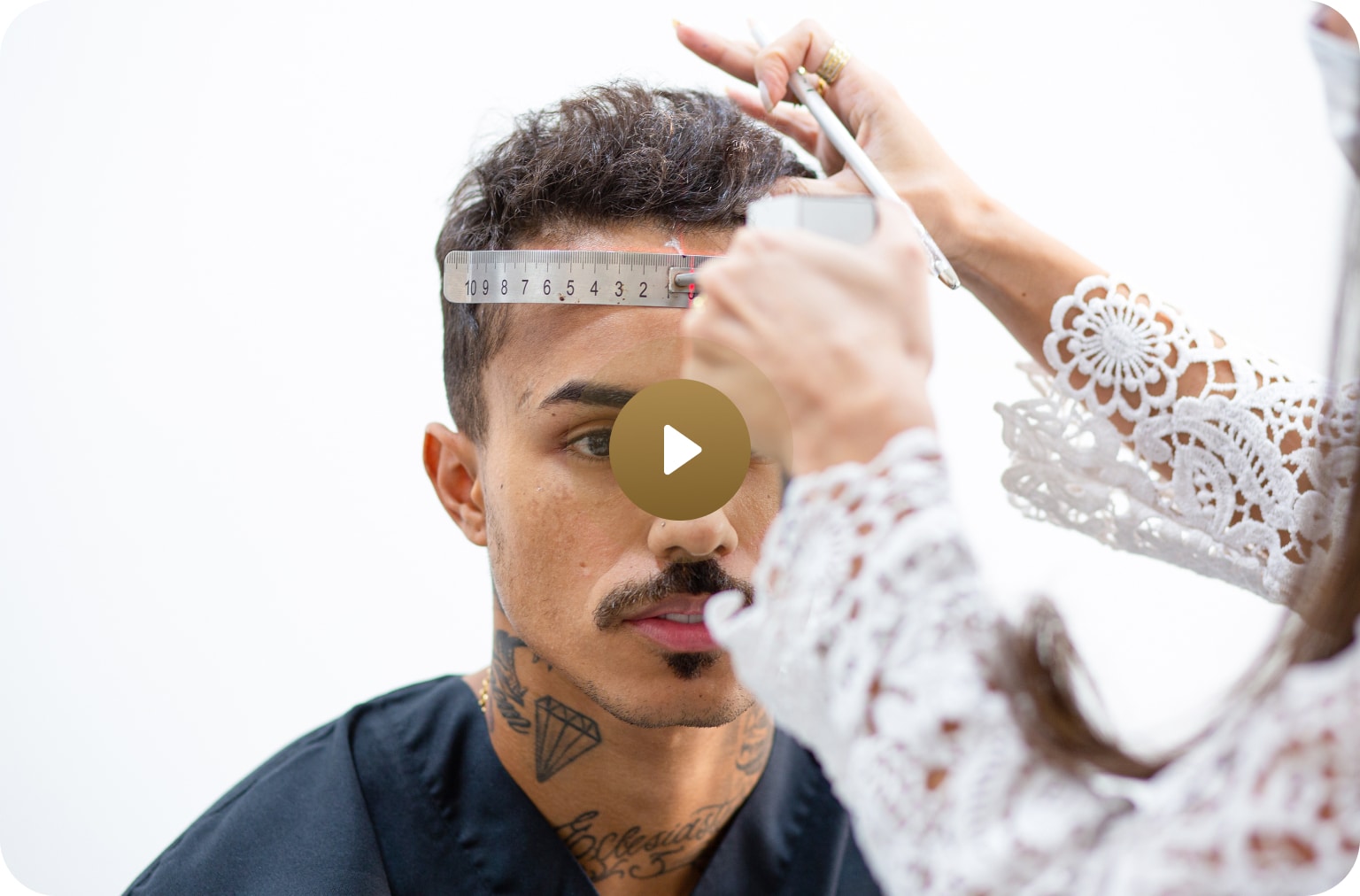 Video thumbnail of @mclivinho after treatment with Vinci Hair Clinic