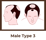 head13 2