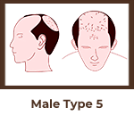 head15 2