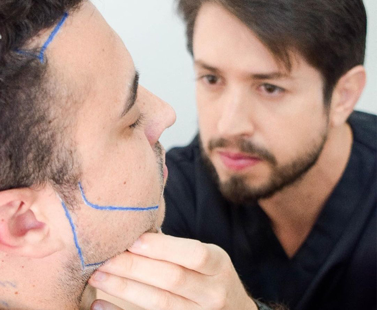 How Long Do Beard Transplants Last