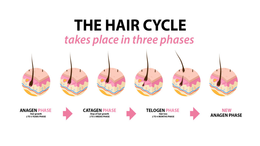 The stages of a hair follicle showing that after shedding comes regrowth after a hairline transplant